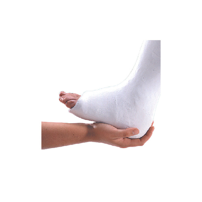 Plaster of Paris Bandage, 15cmx2.7m